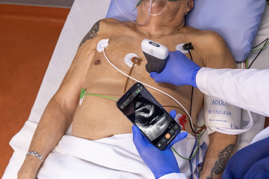 Un appareil à ultrasons est utilisé sur la poitrine d’un patient et le résultat s’affiche sur un téléphone intelligent.
